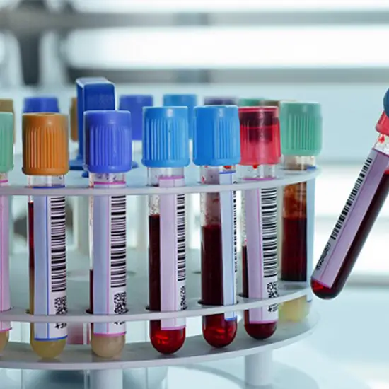 PLA2R Qualitative Test